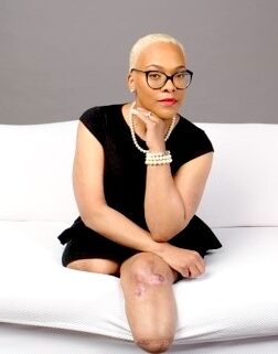 A black woman with light skin, short hair and glasses sitting on a white couch. She is a bilateral leg amputee.